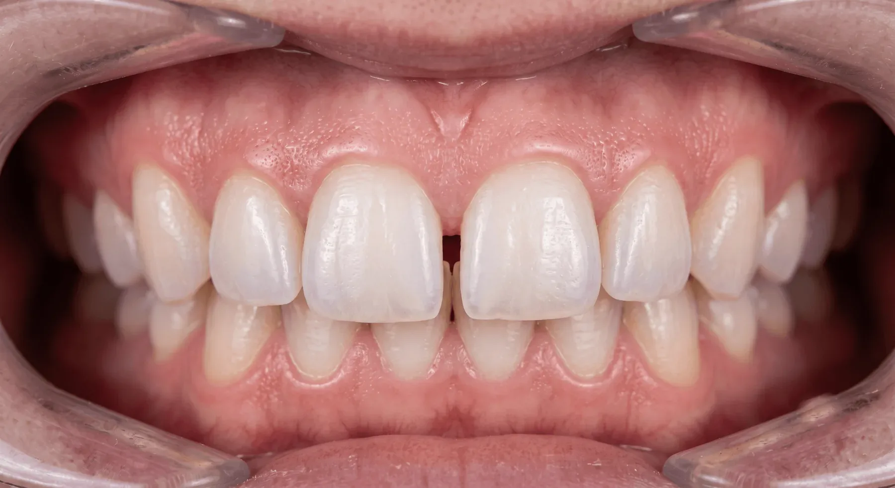 Treatment result before treatment