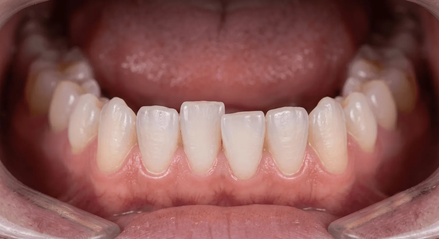 Treatment result before treatment