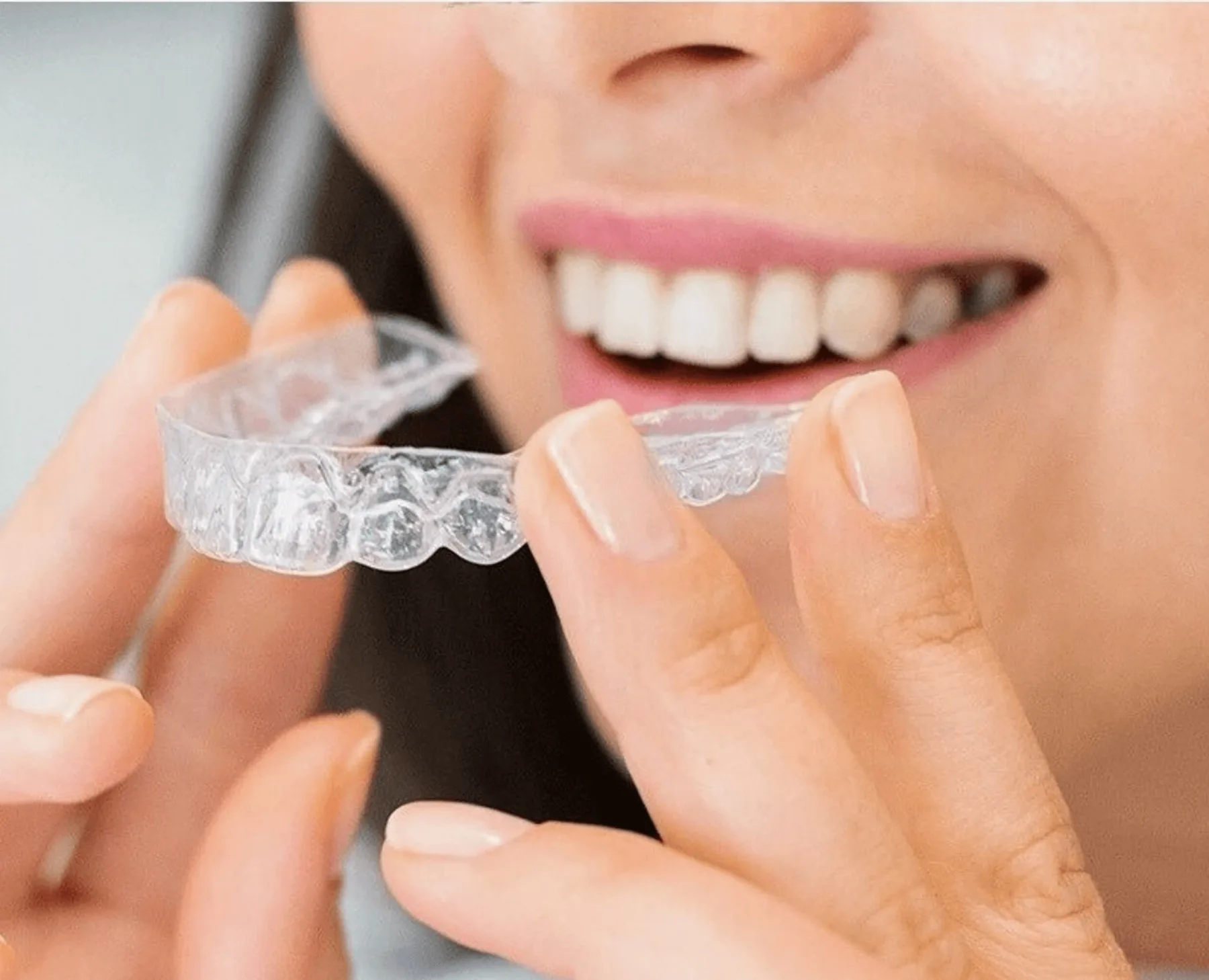 Clear aligners